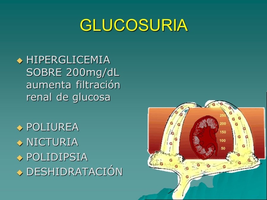 GLUCOSURIA

¢ HIPERGLICEMIA
SOBRE 200mg/dL
aumenta filtracion
renal de glucosa

+ POLIUREA
+ NICTURIA

+ POLIDIPSIA

+ DESHIDRATACION