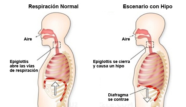 Respiracion Normal Escenario con Hipo
