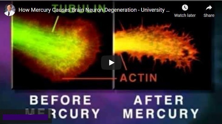 How Mercury Gadses Braid NeuraniDegeneration - University [J fad
re

SINE

2140] ] CLAN
~~ ICURY MERCURY