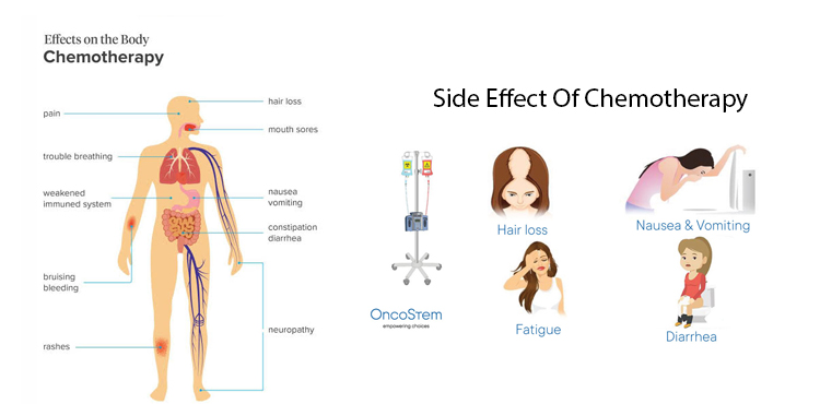 . —— Side Effect Of Chemotherapy
pec a)
-% e
. | 7