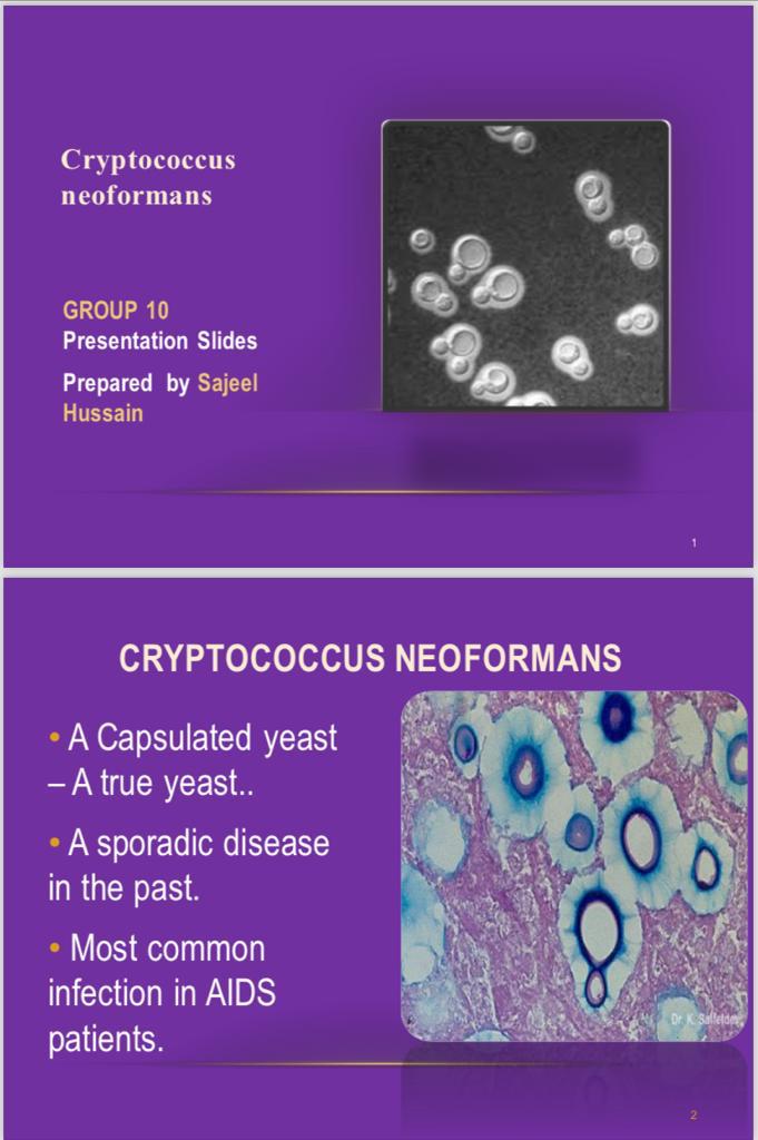 Cryptococcus
neoformans

GROUP 10
Presentation Slides

Prepared by Sajeel
Hussain

+ A Capsulated yeast
—Atrue yeast.

«= A sporadic disease
in the past.

RYN geelnlytehl
infection in AIDS
patients.