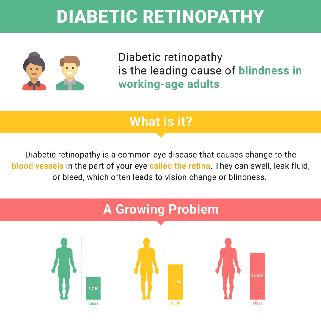 DIABETIC RETINOPATHY

Diabetic retinopathy
- is the leading cause of blindness in
working-age adults.

Diabetic retinopathy is a common eye disease that causes change to the
blood vessels in the part of your eye called the retina. They can swell, leak fluid,
or bleed, which often leads to vision change or blindness.

A Growing Problem

be be he
