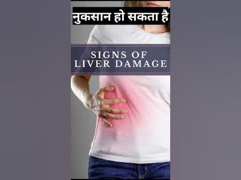 SIGNS OF
LIVER DAMAGE