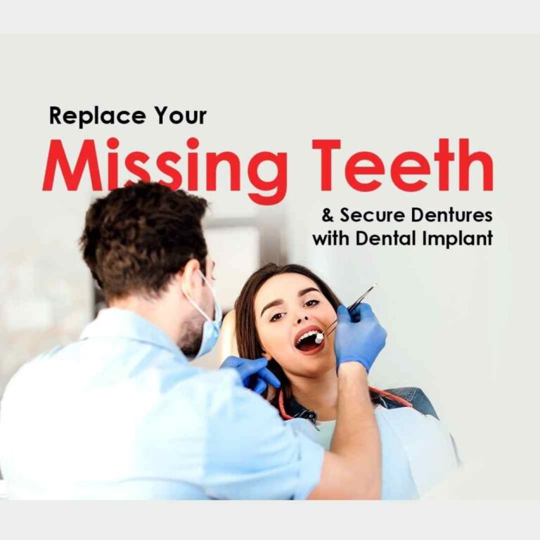 Replace Your

Missing Teeth

& Secure Dentures
with Dental Implant