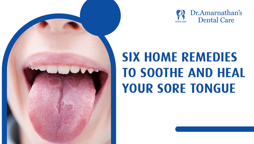 9 Dr.Amarnathan’s
4 Dental Care

SIX HOME REMEDIES
TO SOOTHE AND HEAL
YOUR SORE TONGUE