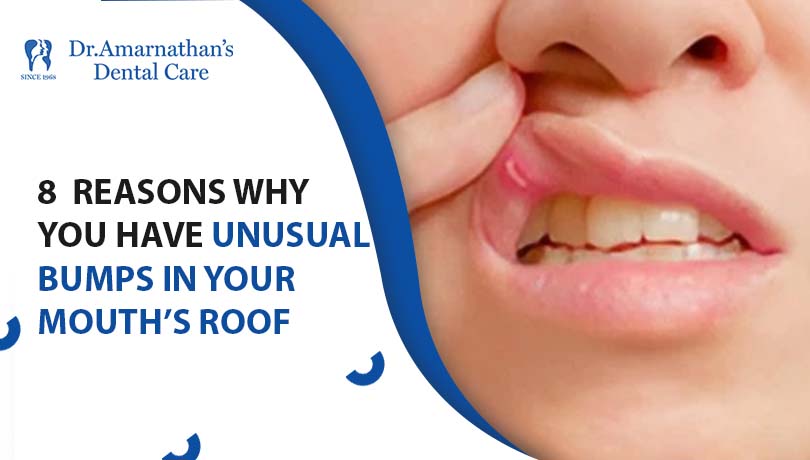7M Dr.Amarnathan’s
+ Dental Care

8 REASONS WHY
YOU HAVE UNUSUAL
BUMPS IN YOUR

) MOUTH’S ROOF

J
9