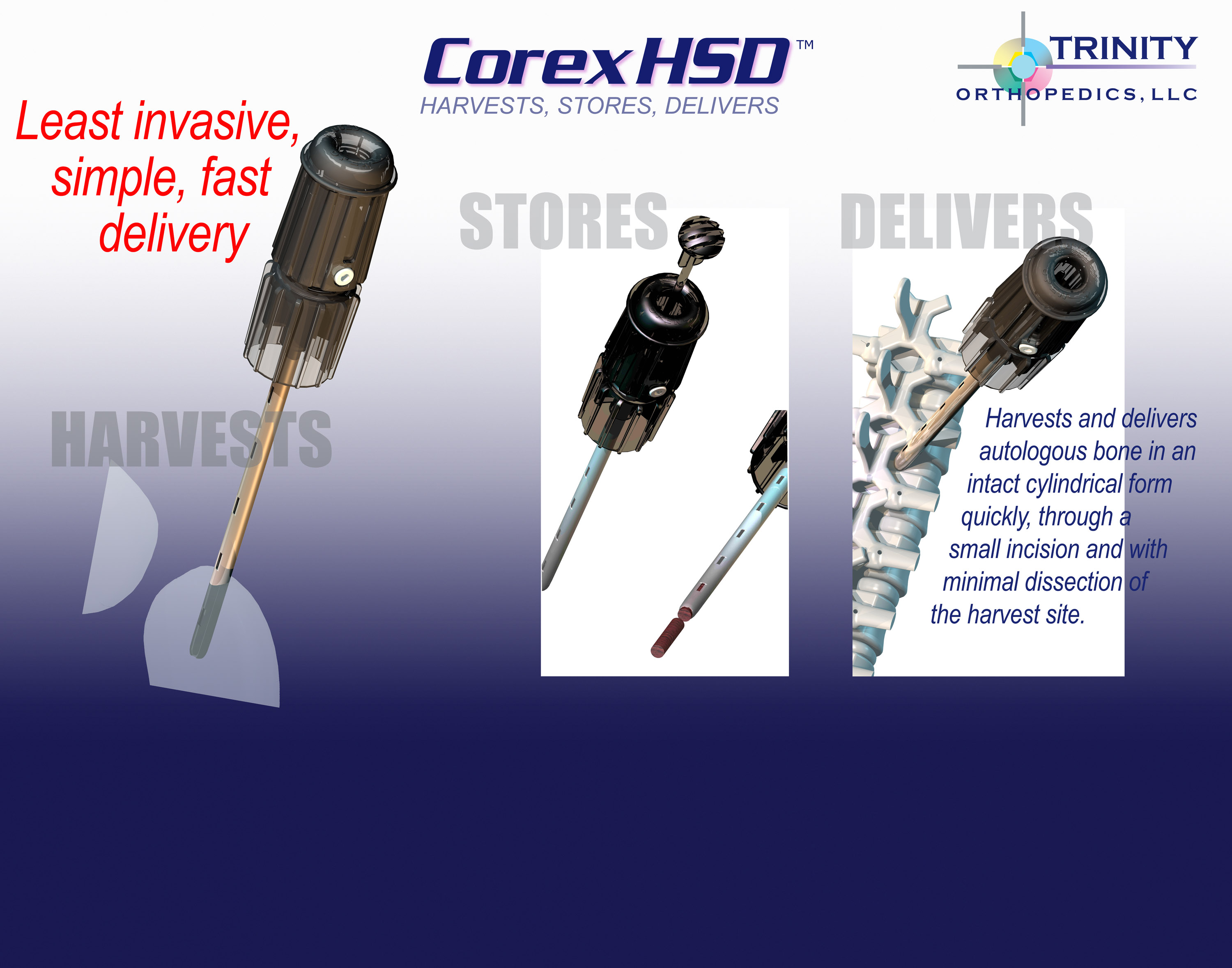 LorexHSD RTI=INITY

HARVESTS, STORES, DELIVERS SIRERSEEDIIC SHEE

Least invasive, gm
simple, fast ja
delivery

J

 
     

(4

     

    

“)
7597
Jr
/» Harvests and delivers
autologous bone in an

!
intact cylindrical form

/ “ly
| - | - quickly, through

   

small incision and
minimal dissection
J] the harvest site.
