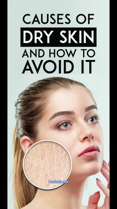 CAUSES OF

DRY SKIN
AND HOW TO

AVOID IT