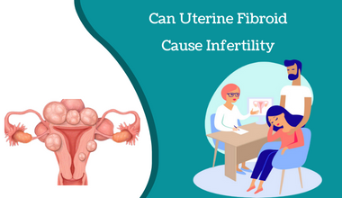 Can Uterine Fibroid

[To

LN