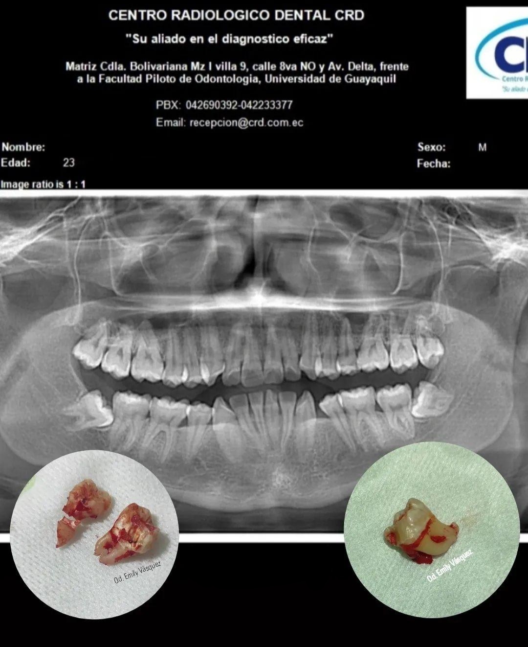 CENTRO RADIOLOGICO DENTAL CRD
"Su aliado en el diagnostico eficaz"

Matriz Cdla. Bolivariana Mz | villa 9, calle Bva NO y Av. Delta, frente
a la Facultad Piloto de Odontologia, Universidad de Guayaquil

PBX: 042690392-042233377
Email: recepcion@crd com ec