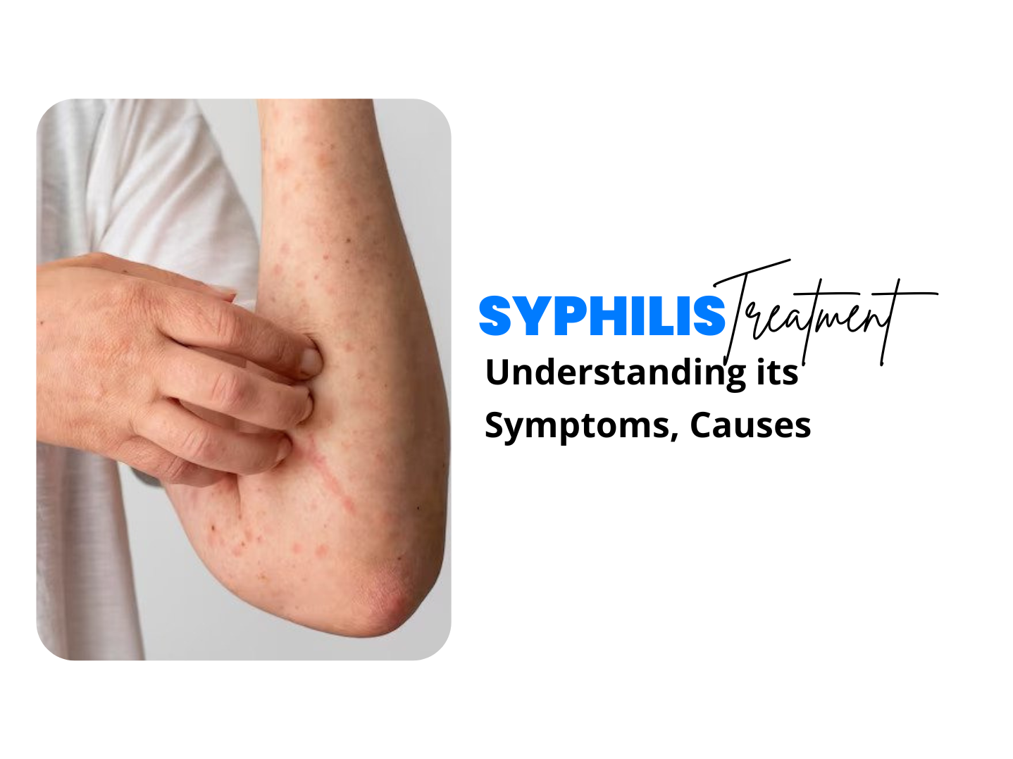 SYPHILIS yuifriif

Understanding its
Symptoms, Causes
