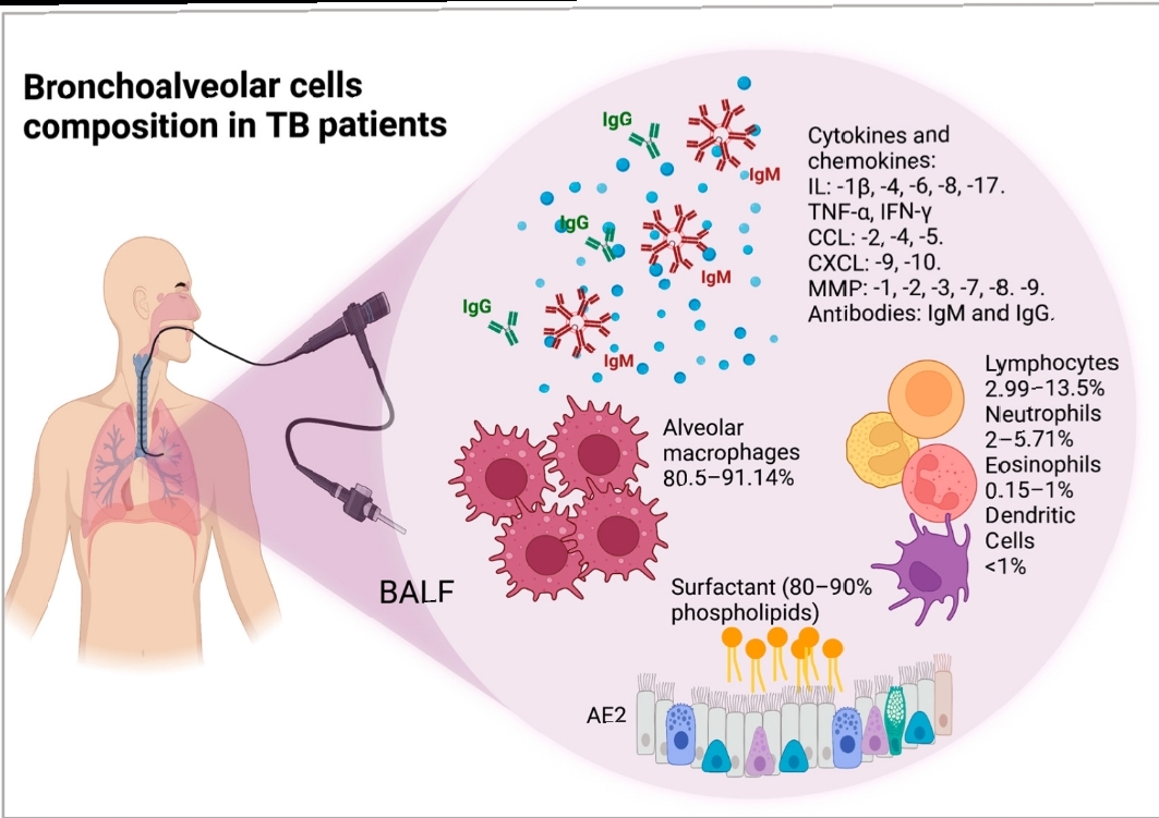 Bronchoalveolar cells
composition in TB patients

 

BALF

AF2

 

  

°
Ar, Cytokines and
chemokines:
o “9M L1p-4,6,8,17.
® TNF-a, IFN-y
CCL: -2.-4,-5.
1oM CXCL:-9,-10.
0 MMP: -1,-2,-3,-7,-8. 9.
. A . Antibodies: IgM and IgG.
“ .
ooo ol Lymphocytes
2.99-13.5%
Alveolar ETT
macrophages | \ Eosinophils
— NX 3
80.5-91.14% BD oso
\_t. Dendritic
Cells
<1%

Surfactant (80-90%
phospholipids)

Pee

 

@
“asa
