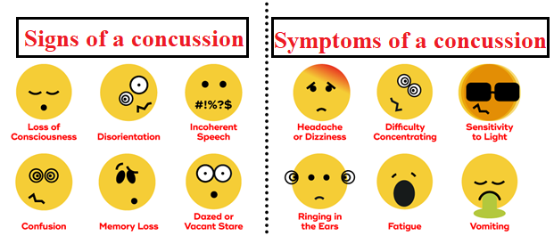 igns of a concussion

T. oo, xr

 

Contama  Memary Lows

 

 

symptoms of a concussion)