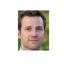 Neograft Hair Restoration Orange County