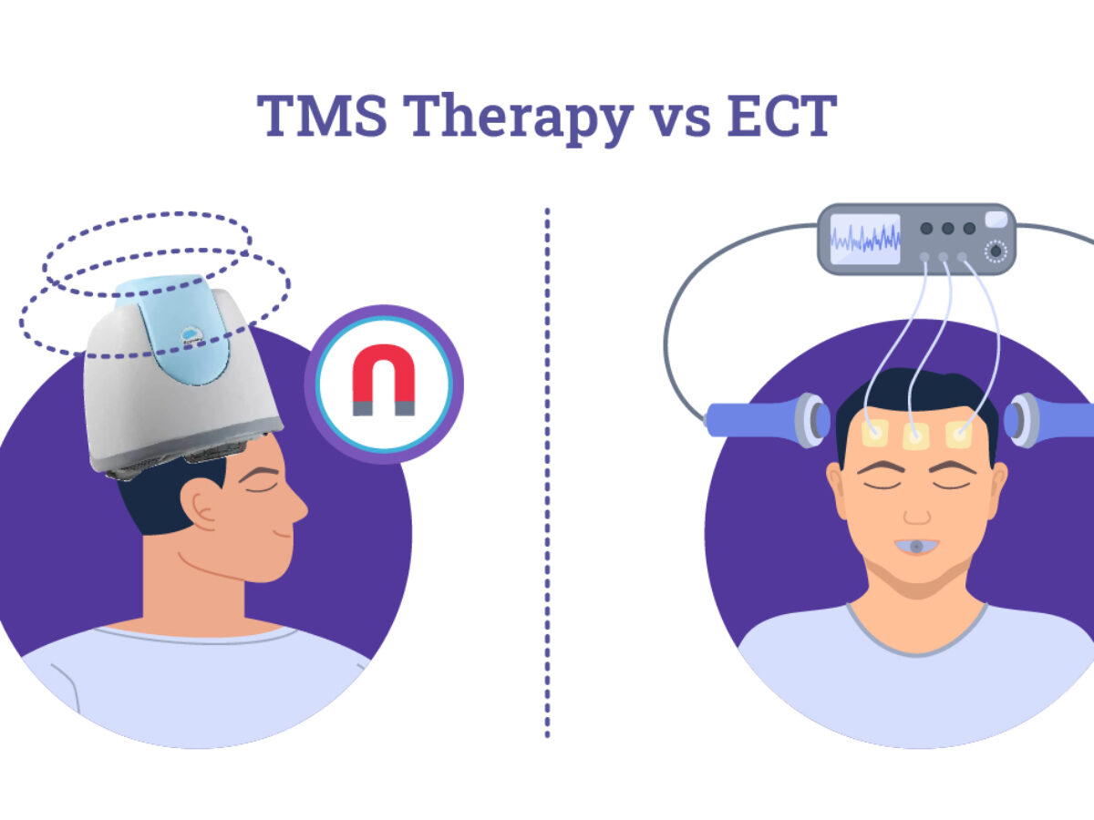 TMS Therapy vs ECT
